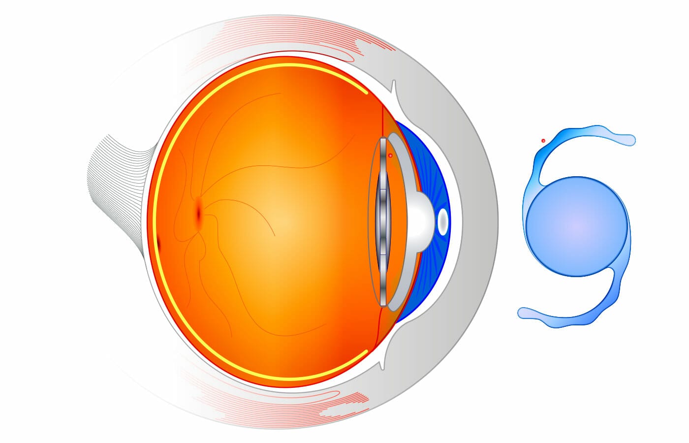 Managing macular degeneration: a guide to available resources and support